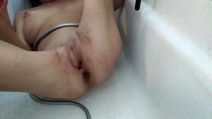 Lizzy Yum - Lizzy Yum Post Op pussy And Verification